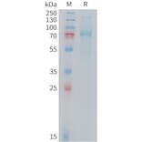 SDS-PAGE - Recombinant Mouse Transferrin Receptor Protein (10xHis Tag) (A325071) - Antibodies.com