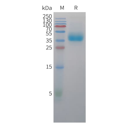 SDS-PAGE - Recombinant Rhesus macaque TROP2 Protein (10xHis Tag) (A325072) - Antibodies.com