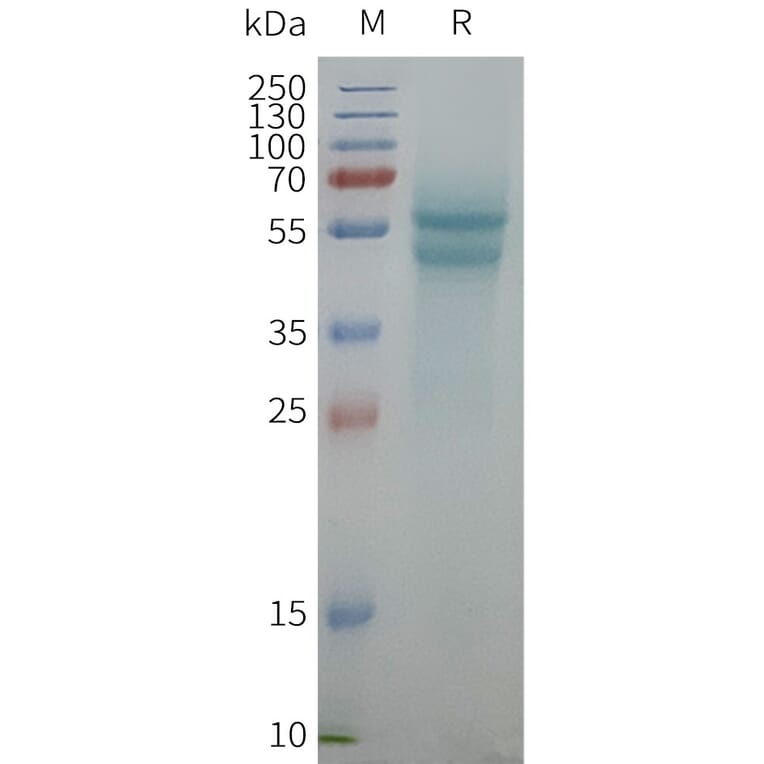 SDS-PAGE - Synthetic Nanodisc Human beta 1 Adrenergic Receptor Protein (A325098) - Antibodies.com