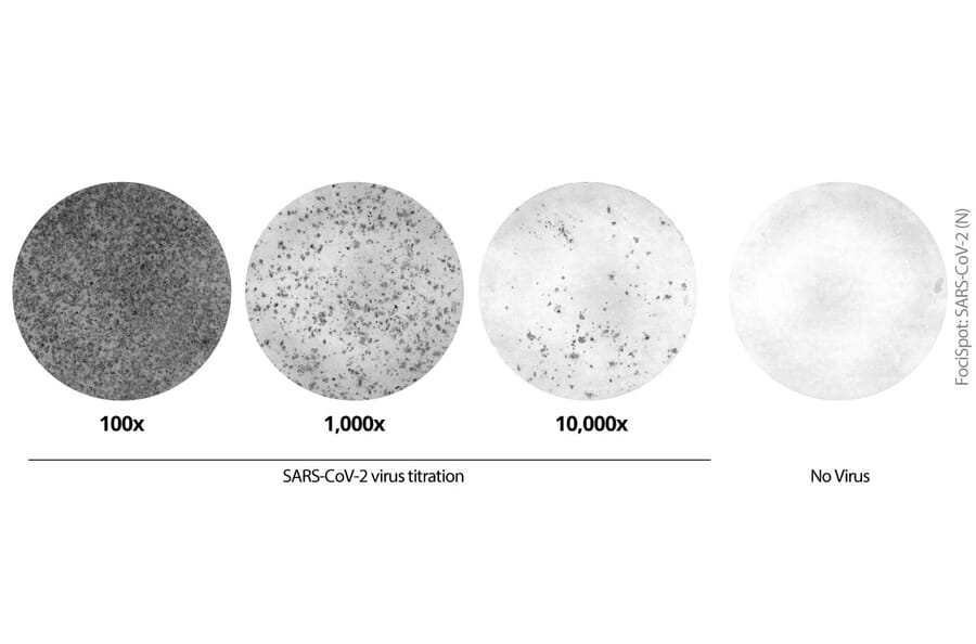 FociSpot - Anti-SARS-CoV-2 Nucleocapsid Protein Antibody [MTCC25] (A325330) - Antibodies.com