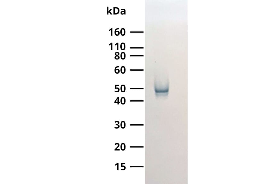 WB - Anti-SARS-CoV-2 Nucleocapsid Protein Antibody [MTCC25] (A325330) - Antibodies.com