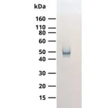WB - Anti-SARS-CoV-2 Nucleocapsid Protein Antibody [MTCC25] (A325330) - Antibodies.com