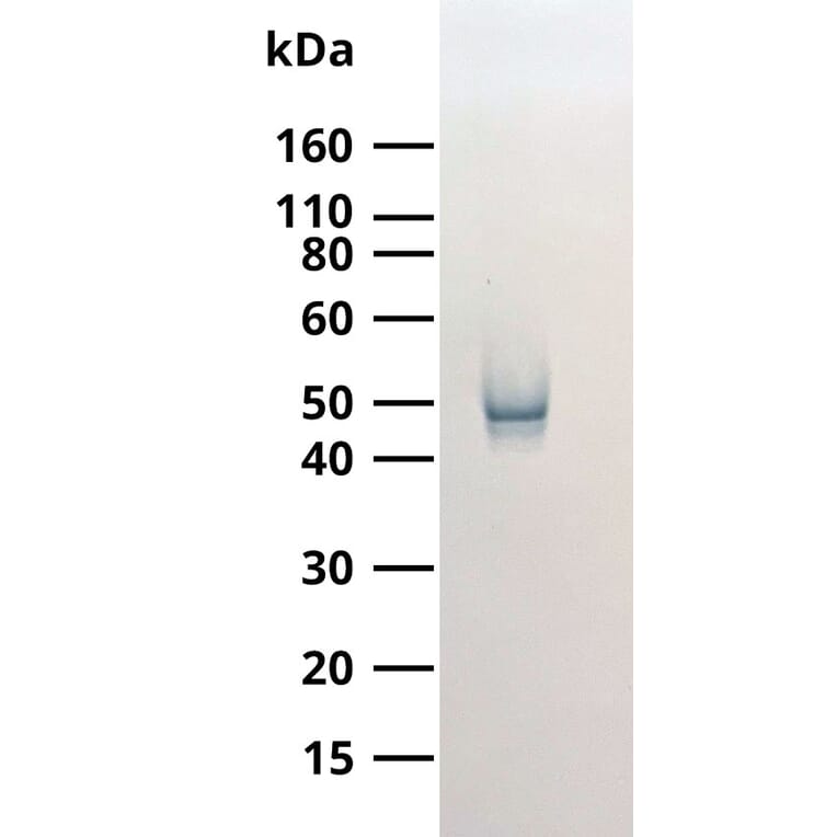 WB - Anti-SARS-CoV-2 Nucleocapsid Protein Antibody [MTCC25] (Biotin) (A325331) - Antibodies.com