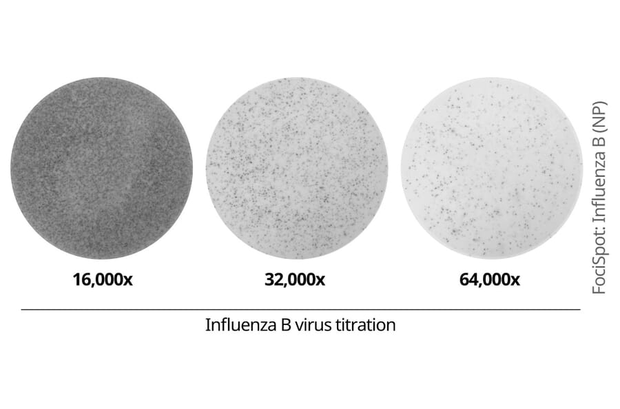 FociSpot - Anti-Influenza B Virus Nucleoprotein Antibody [4D5] (A325383) - Antibodies.com