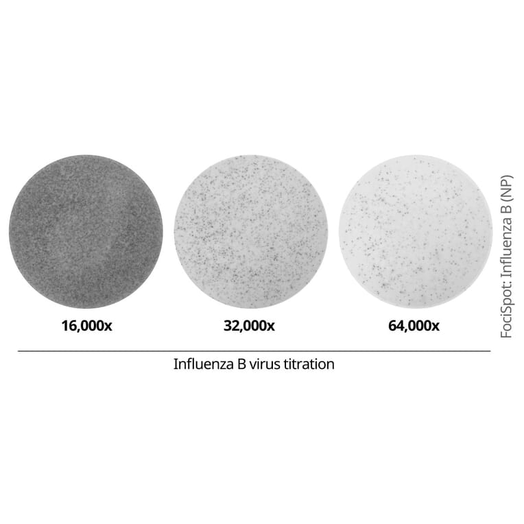 FociSpot - Anti-Influenza B Virus Nucleoprotein Antibody [4D5] (A325383) - Antibodies.com