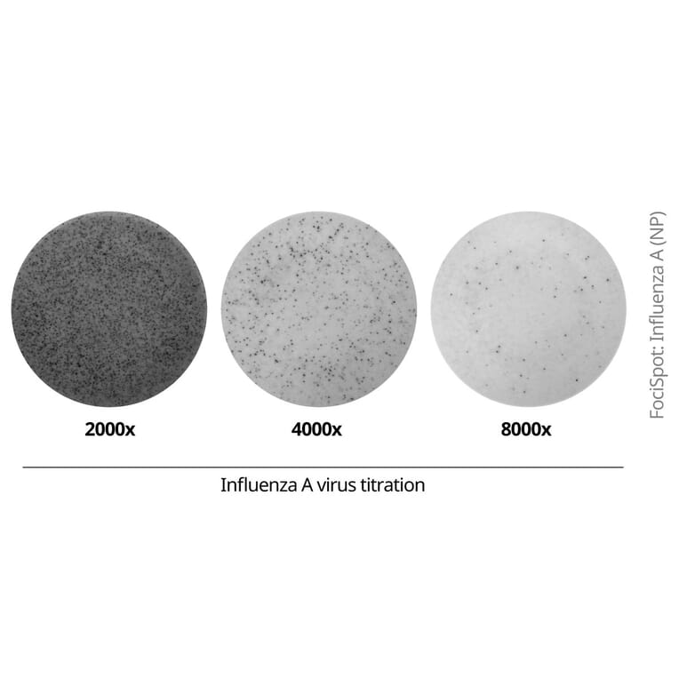 FociSpot - Anti-Influenza A Virus Nucleoprotein Antibody [19C10] (A325385) - Antibodies.com
