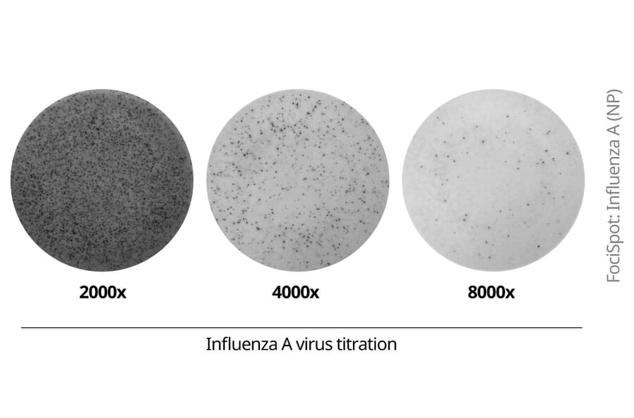 FociSpot - Anti-Influenza A Virus Nucleoprotein Antibody [19C10] (Biotin) (A325386) - Antibodies.com