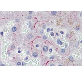 Immunohistochemistry - Anti-ABCB4 Antibody (A326208) - Antibodies.com