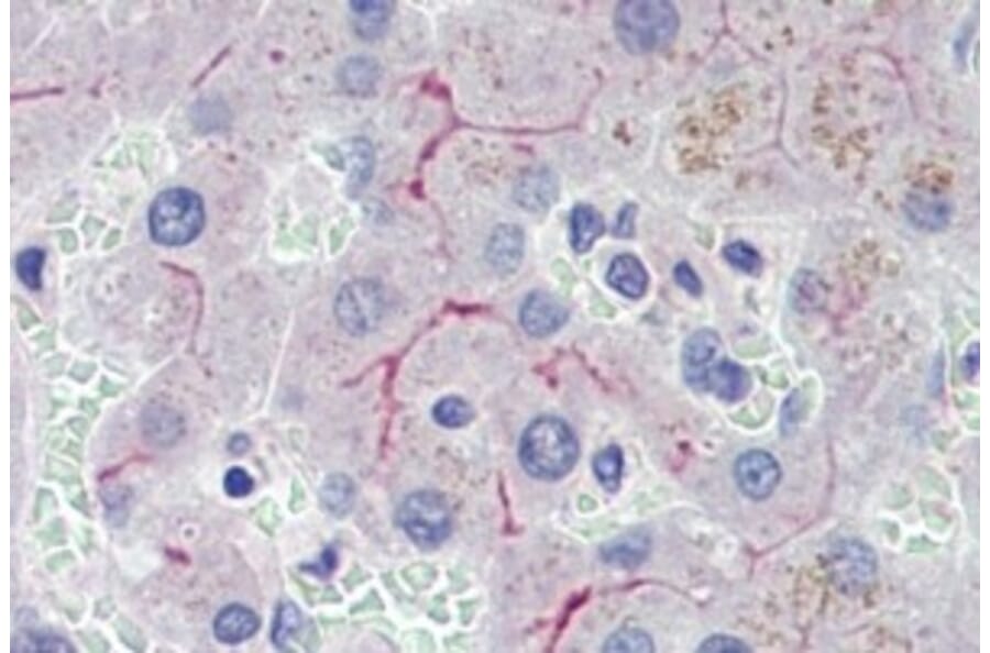 Immunohistochemistry - Anti-ABCB4 Antibody (A326208) - Antibodies.com