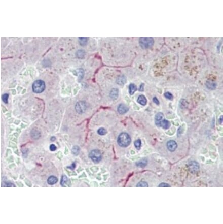 Immunohistochemistry - Anti-ABCB4 Antibody (A326208) - Antibodies.com