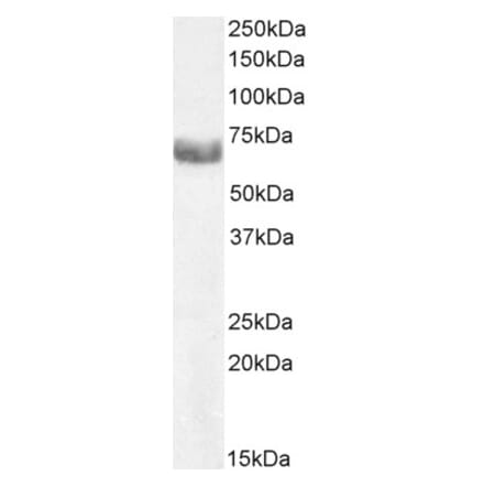 Western Blot - Anti-ABCE1 Antibody (A326209) - Antibodies.com