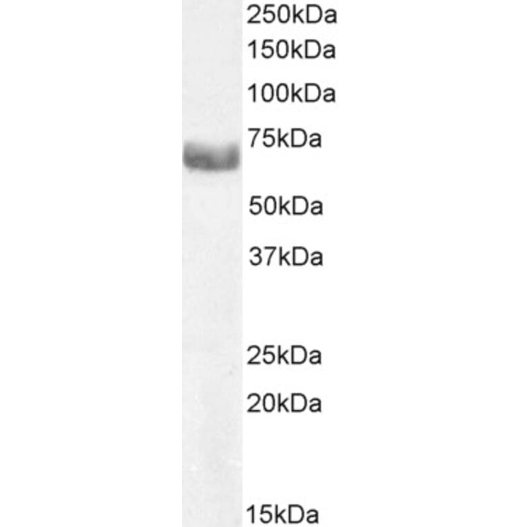 Western Blot - Anti-ABCE1 Antibody (A326209) - Antibodies.com