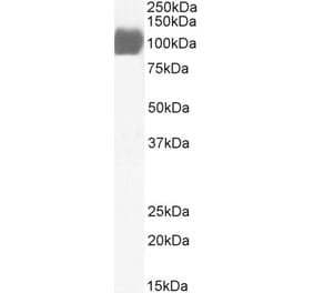 Western Blot - Anti-ACE2 Antibody (A326211) - Antibodies.com