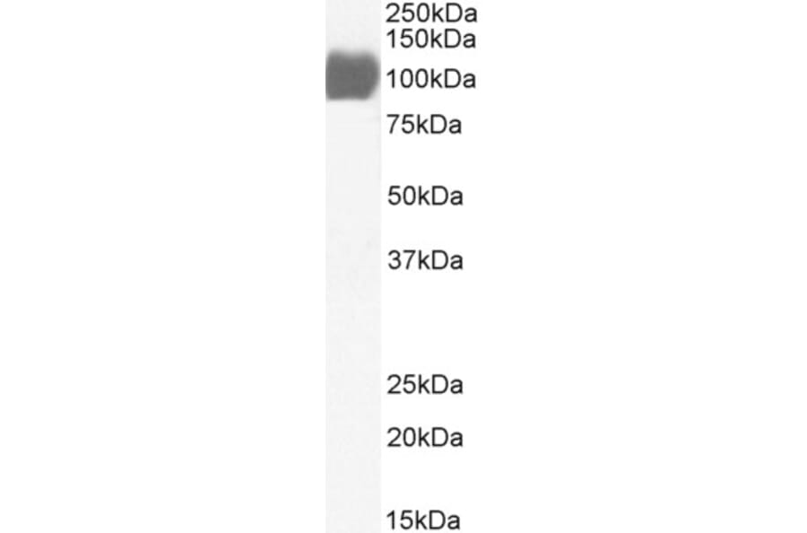 Western Blot - Anti-ACE2 Antibody (A326211) - Antibodies.com