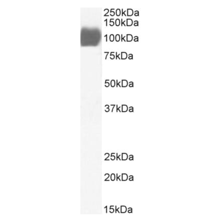 Western Blot - Anti-ACE2 Antibody (A326211) - Antibodies.com