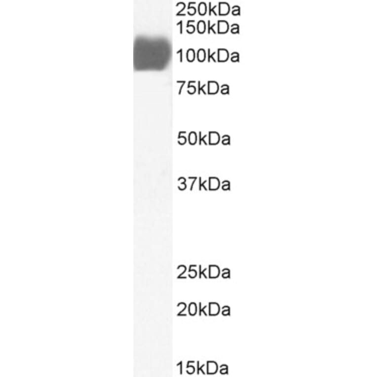 Western Blot - Anti-ACE2 Antibody (A326211) - Antibodies.com