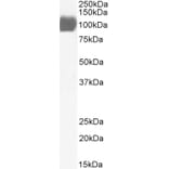Western Blot - Anti-ACE2 Antibody (A326211) - Antibodies.com