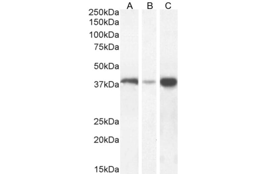 Western Blot - Anti-Alcohol Dehydrogenase Antibody (A326213) - Antibodies.com