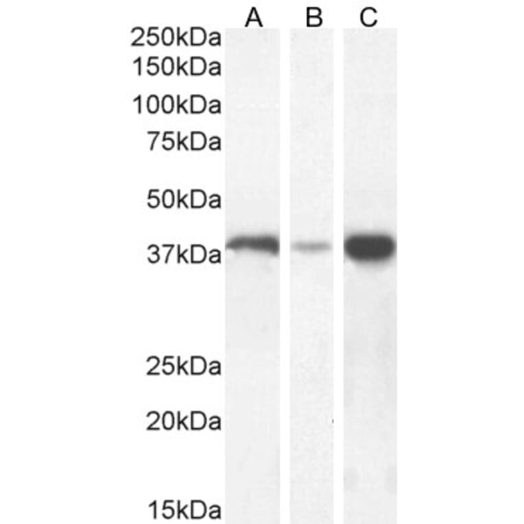 Western Blot - Anti-Alcohol Dehydrogenase Antibody (A326213) - Antibodies.com