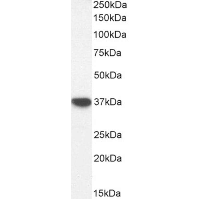 Western Blot - Anti-Alcohol Dehydrogenase Antibody (A326213) - Antibodies.com