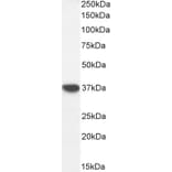 Western Blot - Anti-Alcohol Dehydrogenase Antibody (A326213) - Antibodies.com