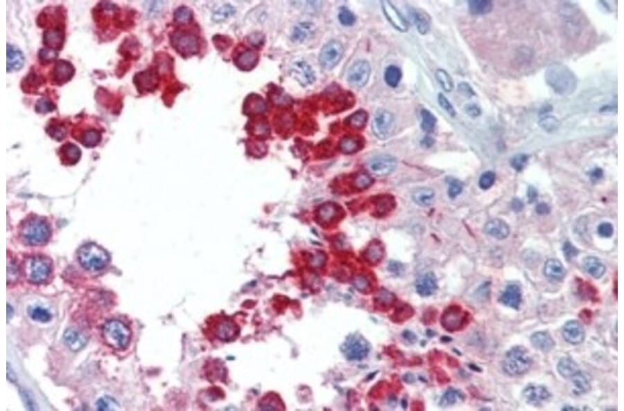 Immunohistochemistry - Anti-ALK Antibody (A326214) - Antibodies.com