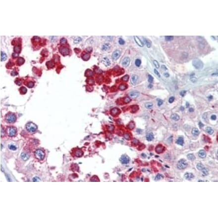 Immunohistochemistry - Anti-ALK Antibody (A326214) - Antibodies.com