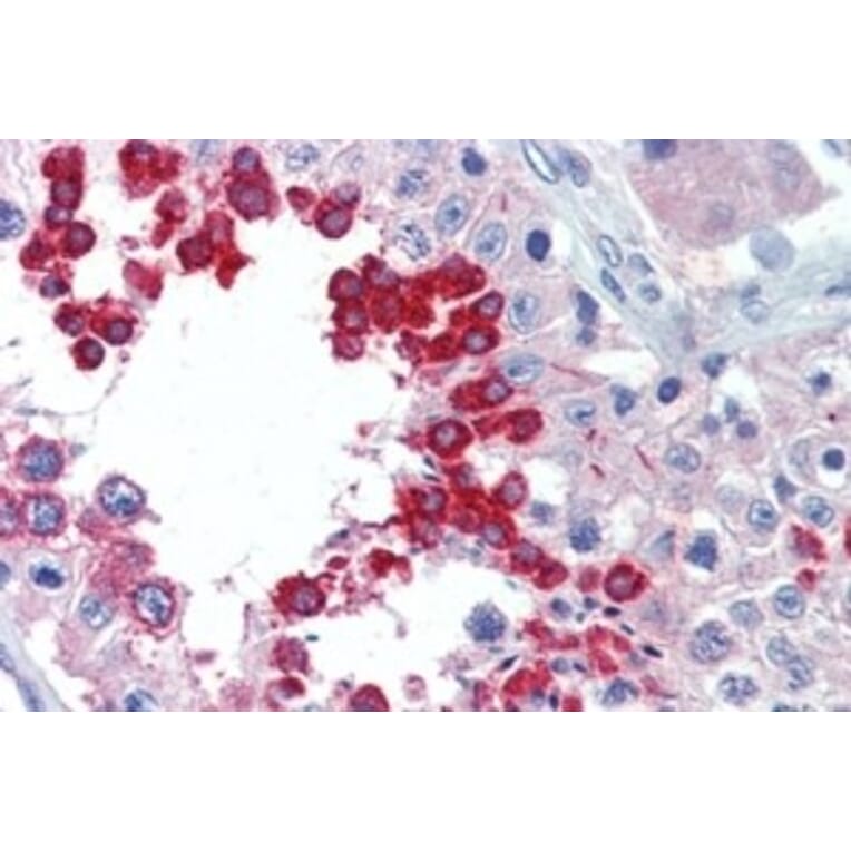 Immunohistochemistry - Anti-ALK Antibody (A326214) - Antibodies.com