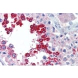 Immunohistochemistry - Anti-ALK Antibody (A326214) - Antibodies.com