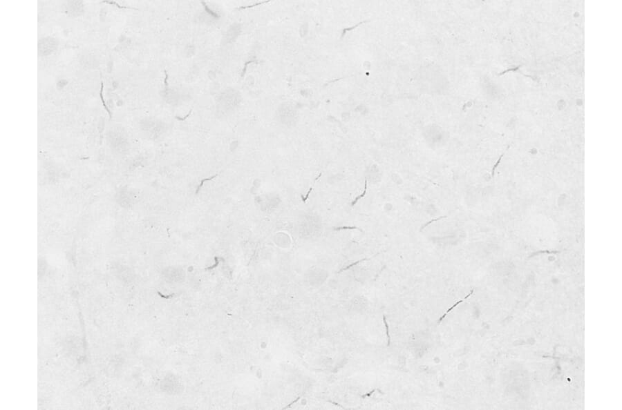Immunohistochemistry - Anti-ANK-3 Antibody (A326215) - Antibodies.com