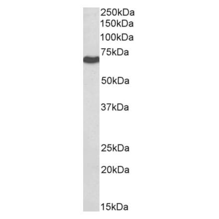 Western Blot - Anti-BTRC Antibody (A326221) - Antibodies.com