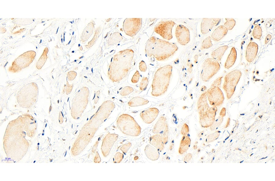 Immunohistochemistry - Anti-BTRC Antibody (A326221) - Antibodies.com