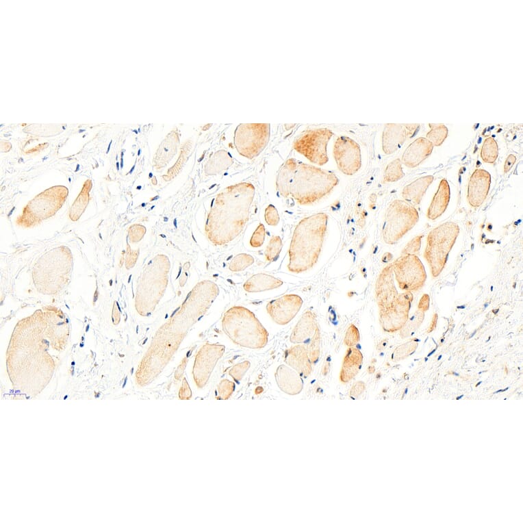 Immunohistochemistry - Anti-BTRC Antibody (A326221) - Antibodies.com