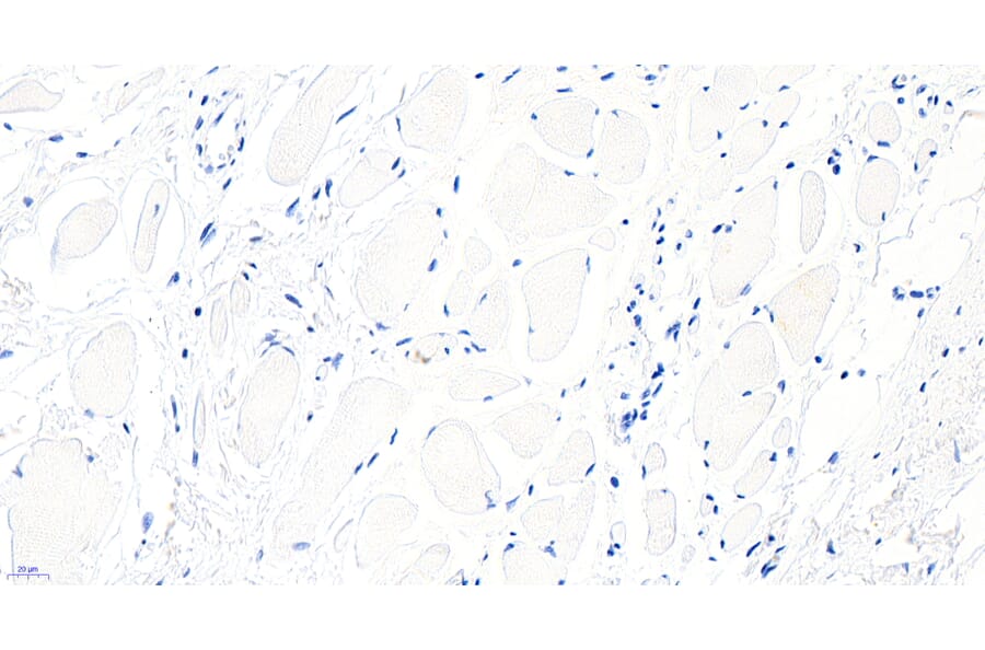 Immunohistochemistry - Anti-BTRC Antibody (A326221) - Antibodies.com