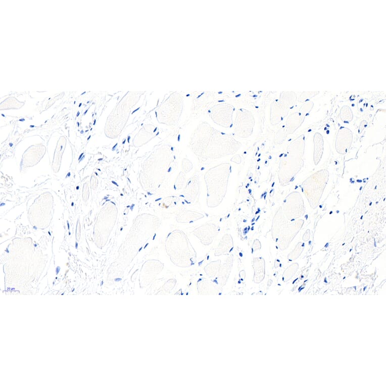 Immunohistochemistry - Anti-BTRC Antibody (A326221) - Antibodies.com