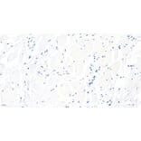 Immunohistochemistry - Anti-BTRC Antibody (A326221) - Antibodies.com