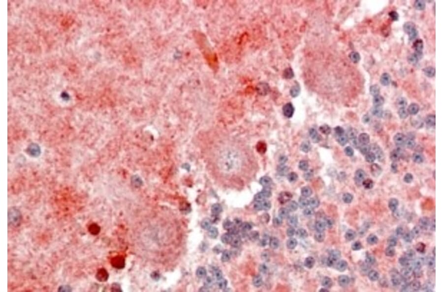 Immunohistochemistry - Anti-BLBP Antibody (A326222) - Antibodies.com