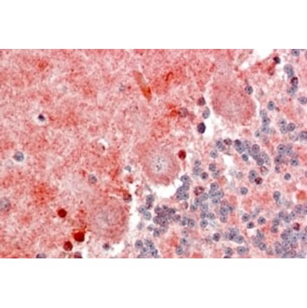 Immunohistochemistry - Anti-BLBP Antibody (A326222) - Antibodies.com