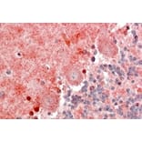 Immunohistochemistry - Anti-BLBP Antibody (A326222) - Antibodies.com