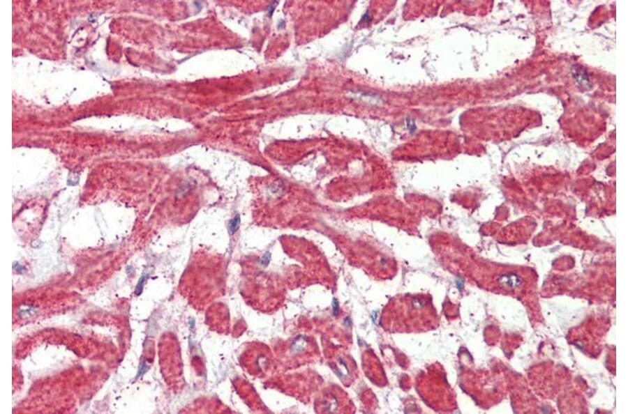 Immunohistochemistry - Anti-BLBP Antibody (A326222) - Antibodies.com