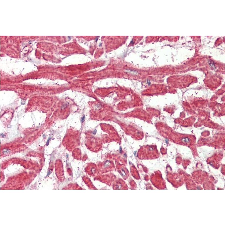 Immunohistochemistry - Anti-BLBP Antibody (A326222) - Antibodies.com