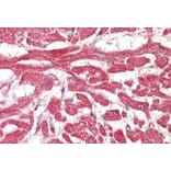 Immunohistochemistry - Anti-BLBP Antibody (A326222) - Antibodies.com