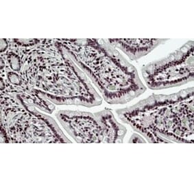 Immunohistochemistry - Anti-BRG1 Antibody (A326223) - Antibodies.com