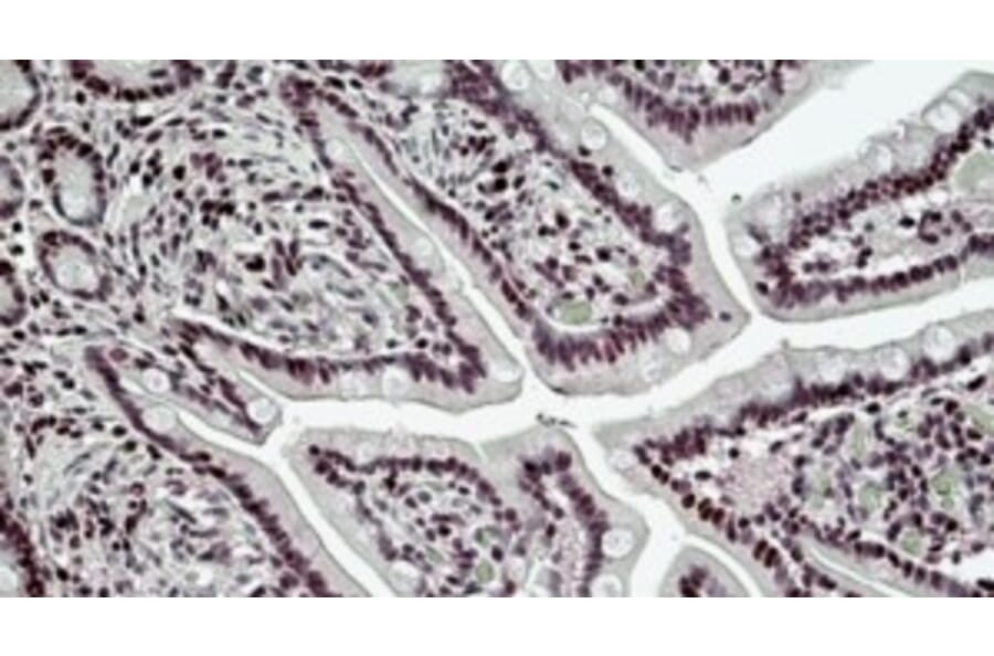 Immunohistochemistry - Anti-BRG1 Antibody (A326223) - Antibodies.com