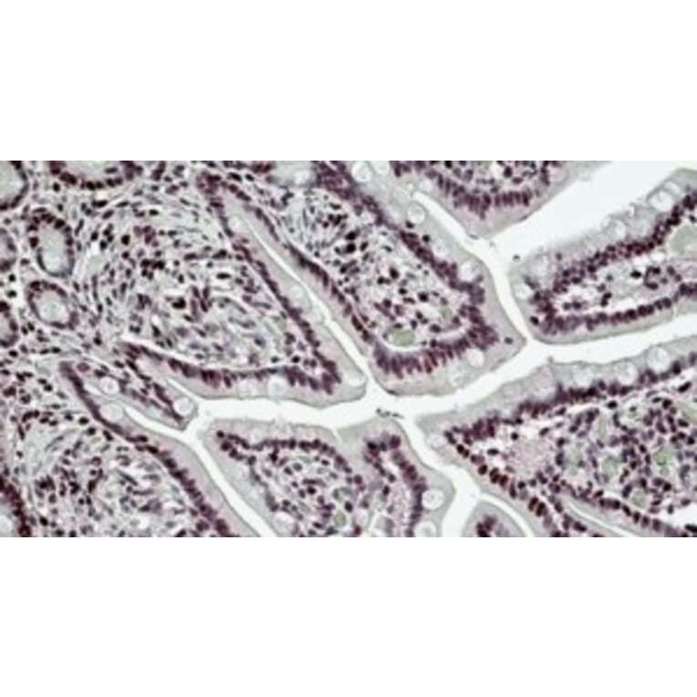 Immunohistochemistry - Anti-BRG1 Antibody (A326223) - Antibodies.com