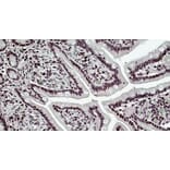 Immunohistochemistry - Anti-BRG1 Antibody (A326223) - Antibodies.com