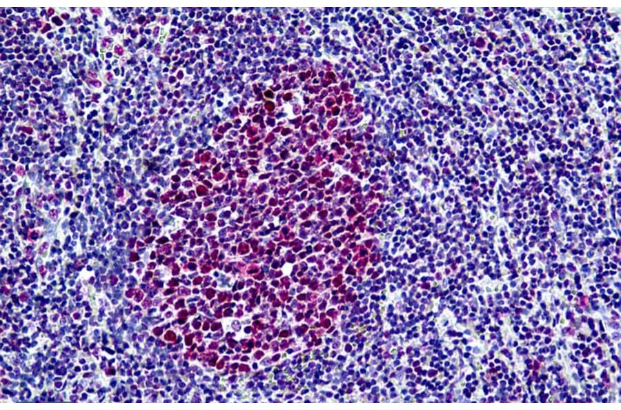 Immunohistochemistry - Anti-BRG1 Antibody (A326223) - Antibodies.com