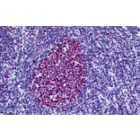 Immunohistochemistry - Anti-BRG1 Antibody (A326223) - Antibodies.com