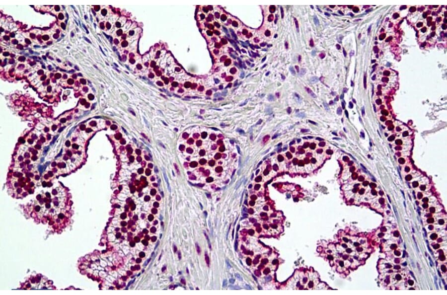 Immunohistochemistry - Anti-BRG1 Antibody (A326223) - Antibodies.com