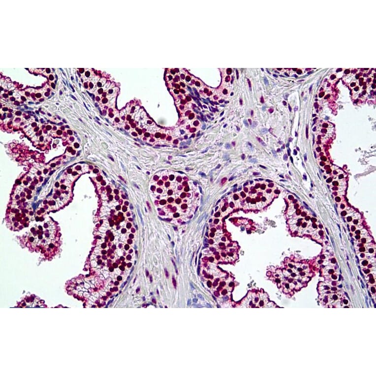 Immunohistochemistry - Anti-BRG1 Antibody (A326223) - Antibodies.com